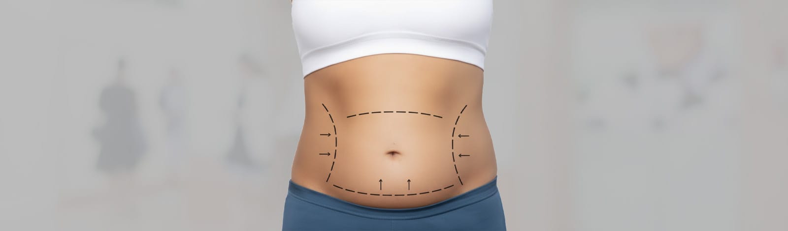 What is a Mommy Makeover Surgery?