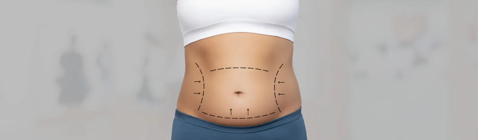 Mommy Makeover Surgery in Gurgaon – Surgeons and Cost Guide