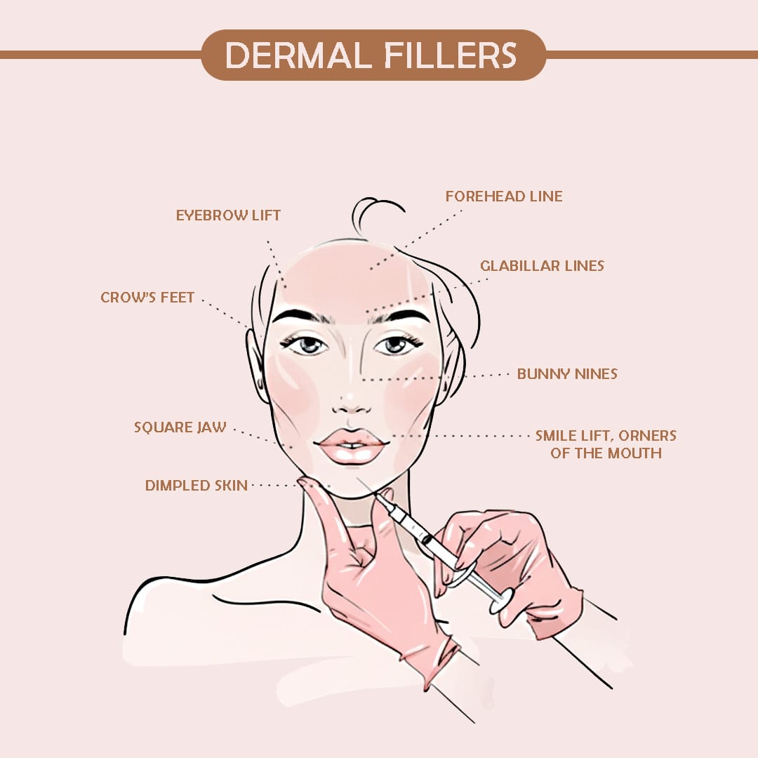 Dermal Fillers