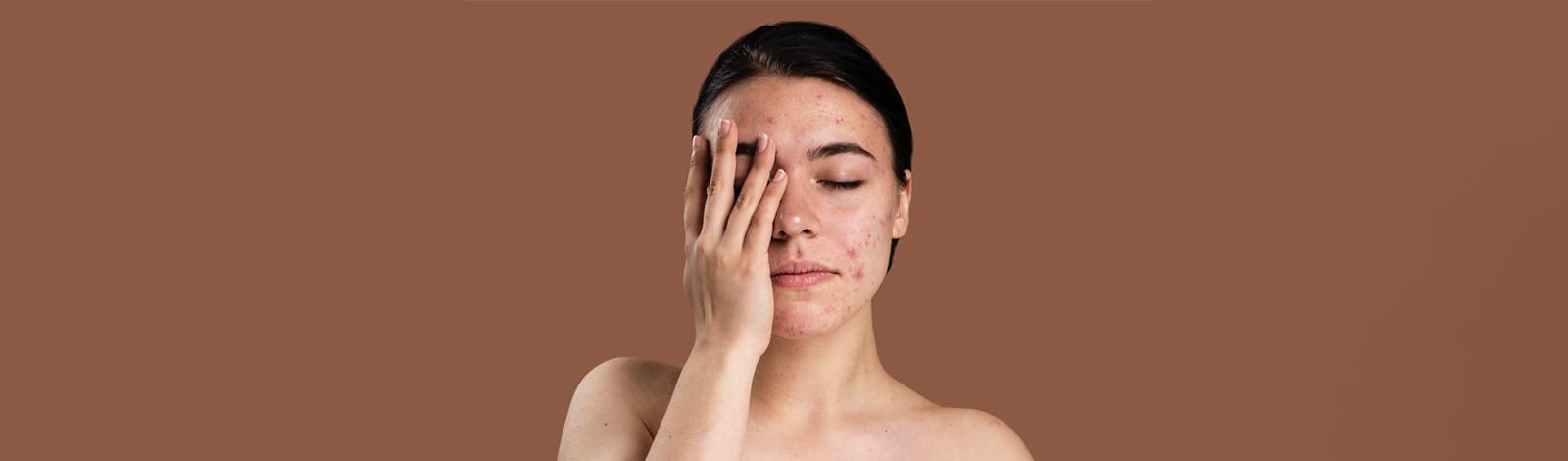 Want clearer, smoother skin? Here are the best dermatologist – approved treatments to remove scars