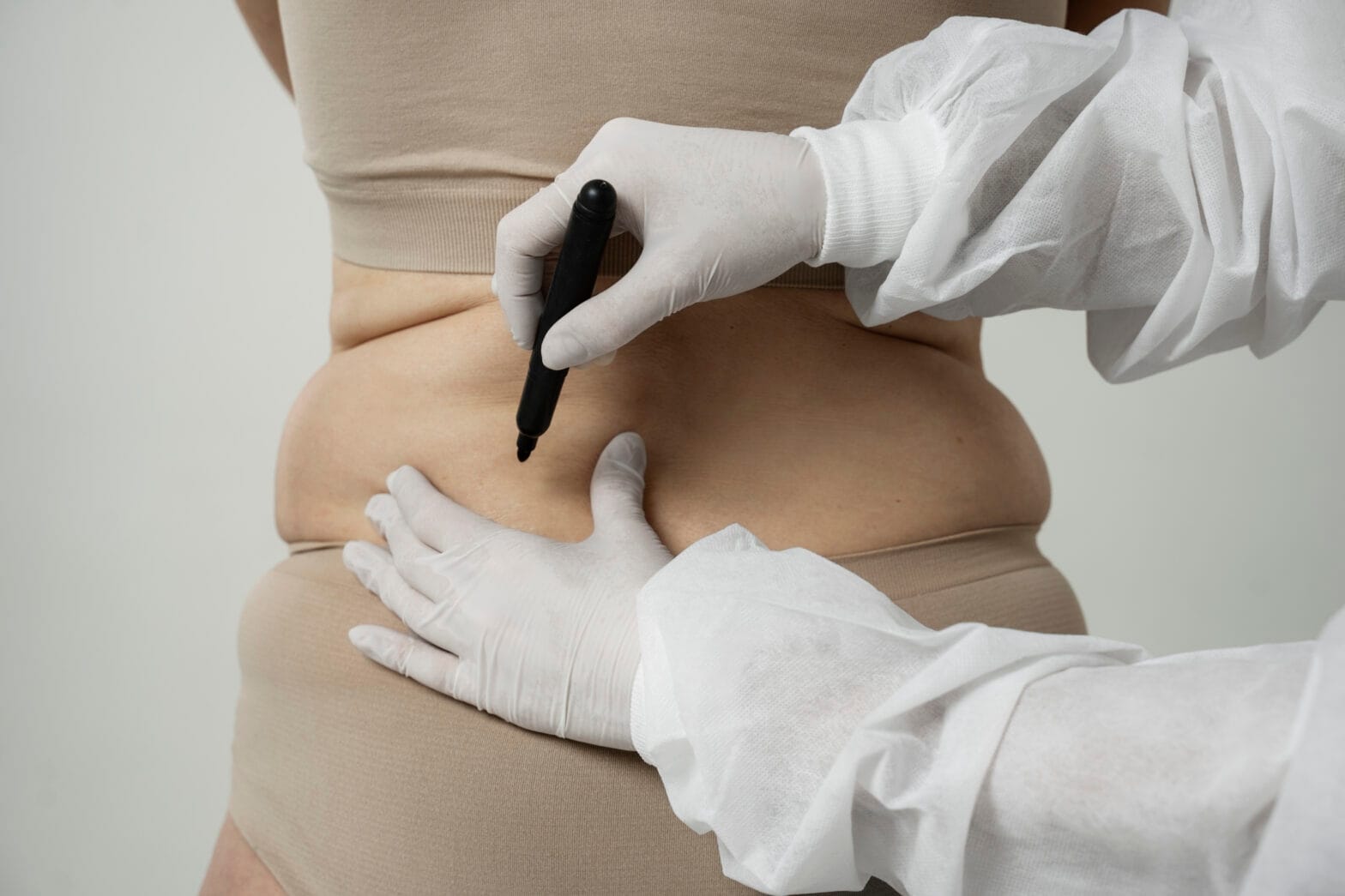pre-op instruction for liposuction