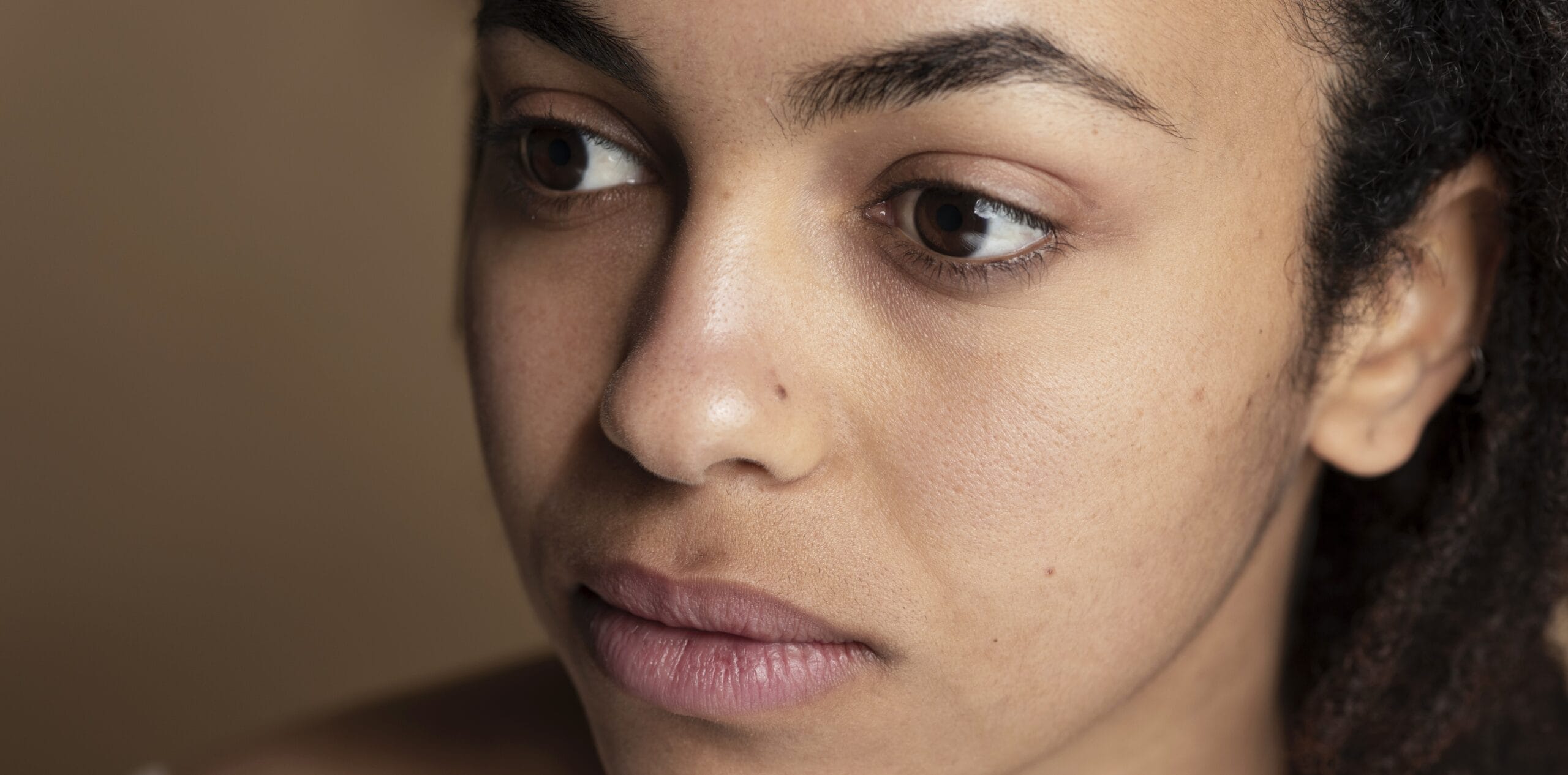 Acne Scar Treatment Mistakes to Avoid in Your 20s and 30s