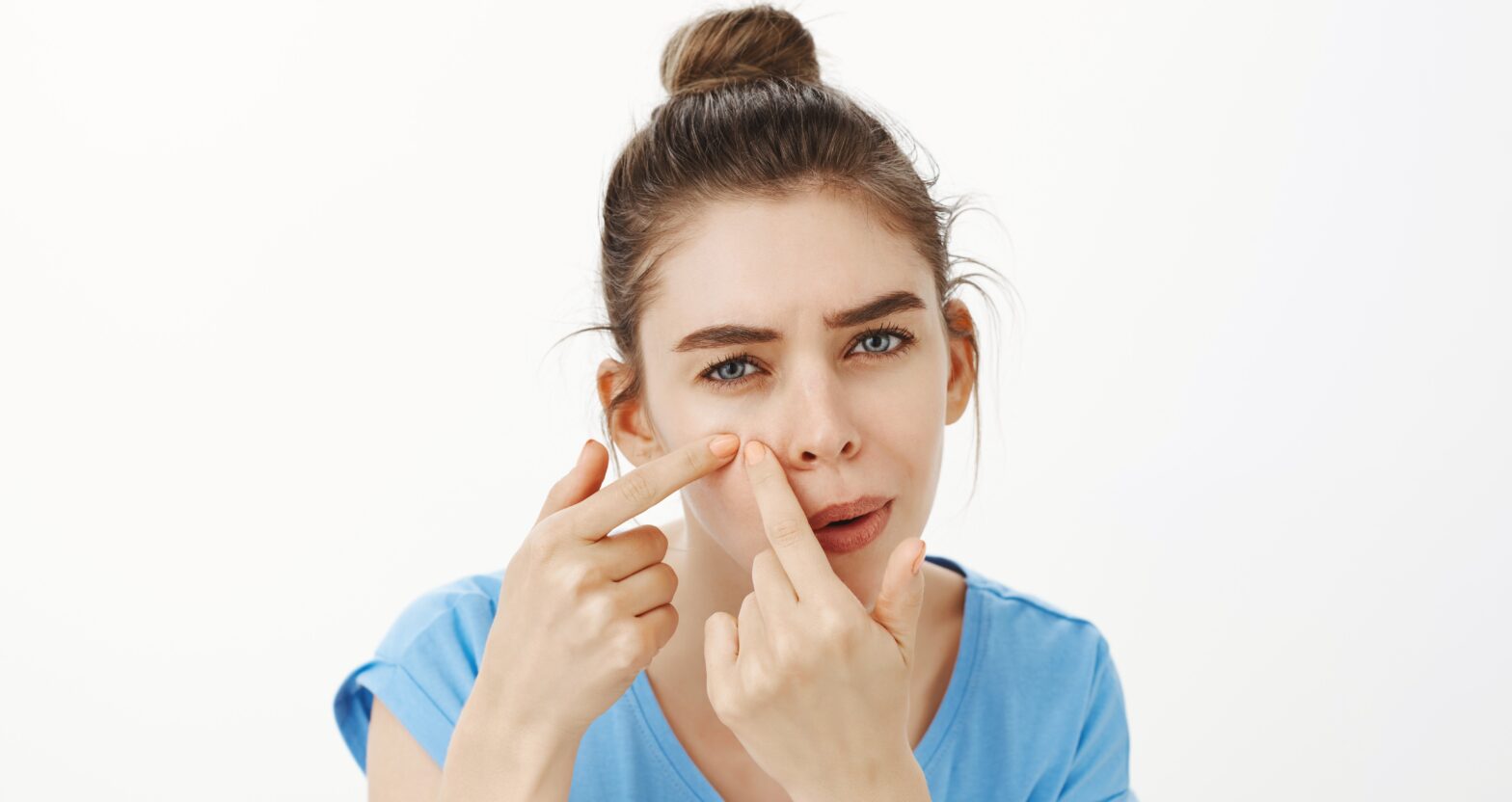 dermatologist-led acne treatment in gurgaon for teenagers