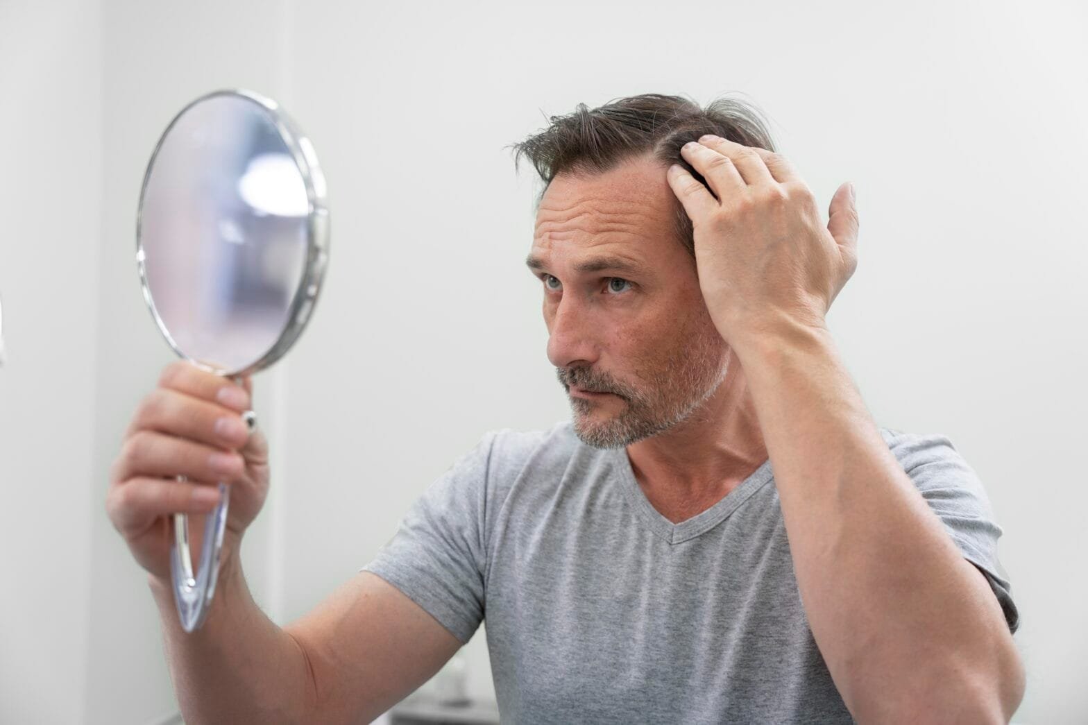 Good Candidate for Hair Transplant