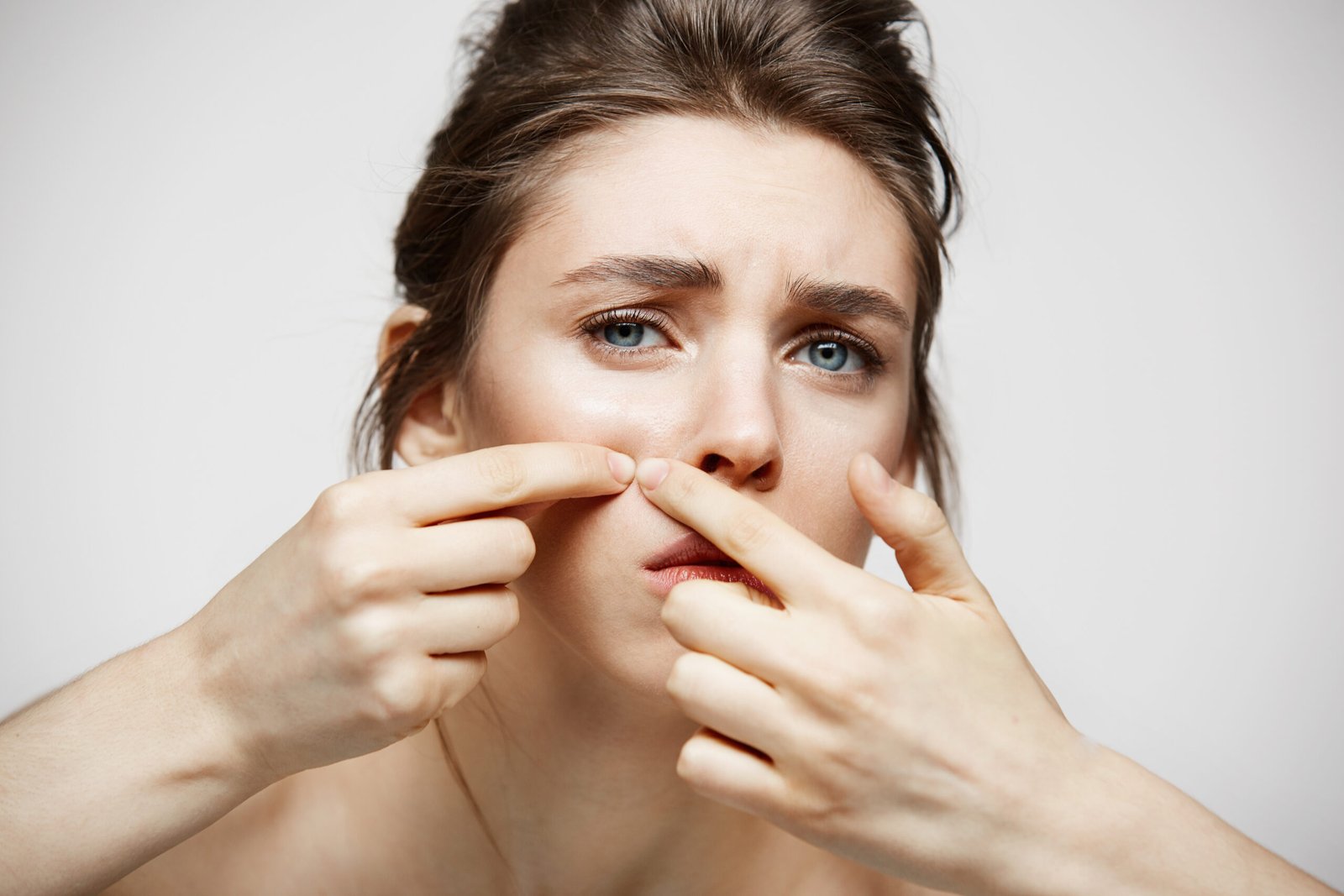 Acne & Pimples Treatment in Gurgaon – Expert Dermatologist Clinic Near You
